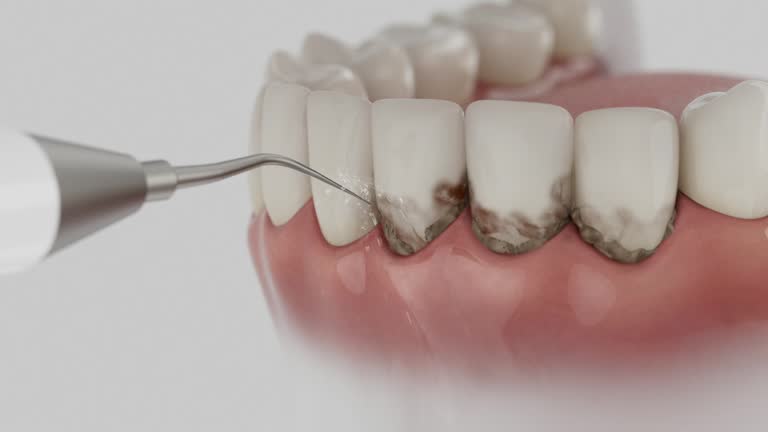 Trusted Teeth Cleaning And Checkup service in Schererville, IN - Dentist Open Now